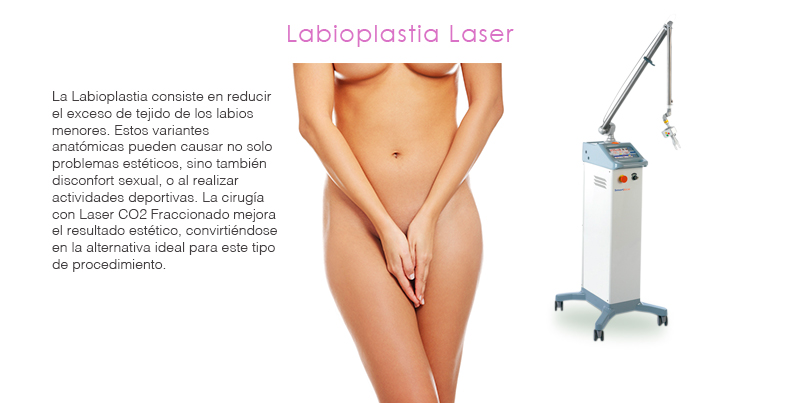 Labioplastia Laser